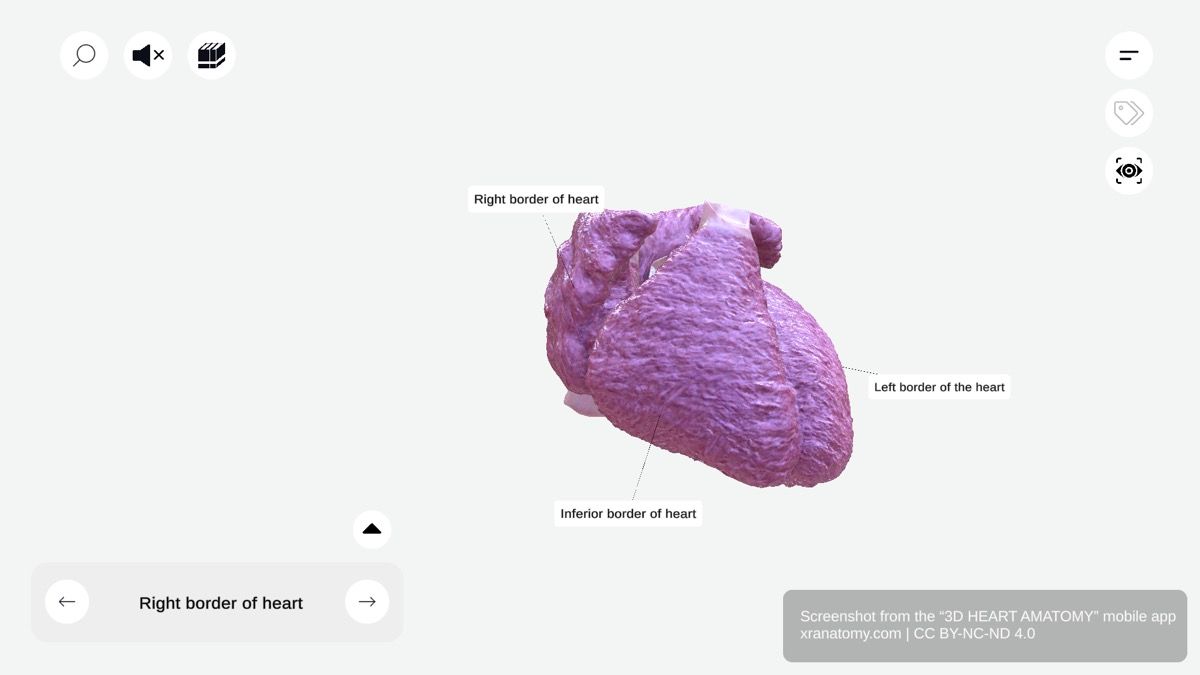 Heart borders 360-degree interactive viewer showing right border formed by superior vena cava and right atrium, used for assessing right atrial enlargement